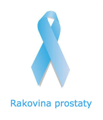 Rakovina prostaty Rakovina prostaty