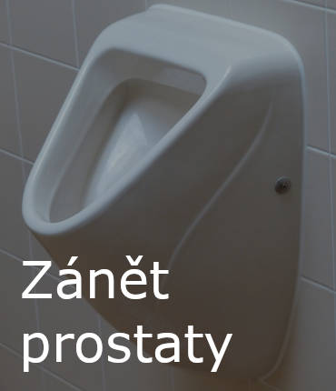Zánět prostaty